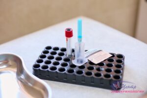 Подробнее о статье Ведение беременных с гестационным сахарным диабетом